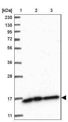 Western Blot: NDUFAF3 Antibody [NBP1-89382] - Lane 1: Marker  [kDa] 230, 130, 95, 72, 56, 36, 28, 17, 11.  Lane 2: Human cell line RT-4.  Lane 3: Human cell line U-251MG sp