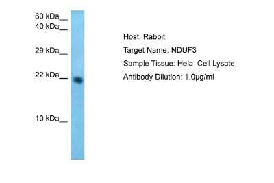 Western Blot: NDUFAF3 Antibody [NBP2-85369] - Host: Rabbit. Target Name: NDUF3. Sample Type: Hela Whole Cell. Antibody Dilution: 1.0ug/ml