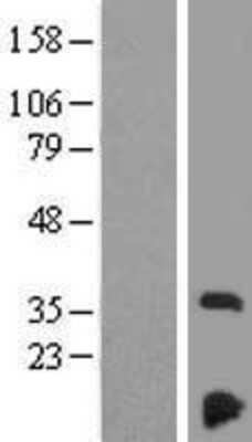 Western Blot NDUFAF3 Overexpression Lysate