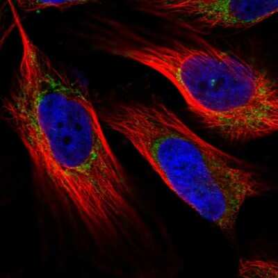 Immunocytochemistry/Immunofluorescence: NDUFAF4 Antibody [NBP1-92171] - Immunofluorescent staining of human cell line U-251 MG shows localization to mitochondria.