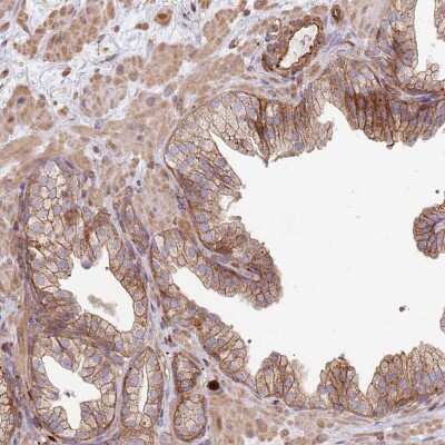 Immunohistochemistry-Paraffin: NDUFAF4 Antibody [NBP1-92171] - Staining of human prostate shows moderate membranous and cytoplasmic positivity in glandular cells.