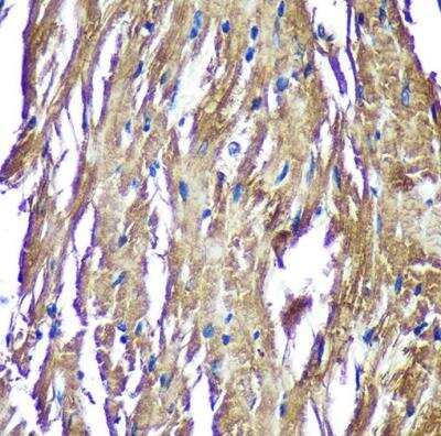 Immunohistochemistry-Paraffin: NDUFAF4 Antibody [NBP2-93264] - Mouse heart using NDUFAF4 Rabbit pAb (A14345) at dilution of 1:100 (40x lens).