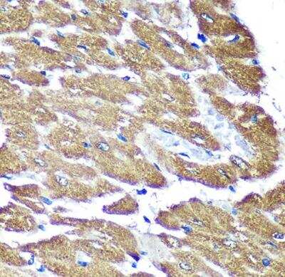 Immunohistochemistry-Paraffin: NDUFAF4 Antibody [NBP2-93264] - Rat heart using NDUFAF4 Rabbit pAb (A14345) at dilution of 1:100 (40x lens).