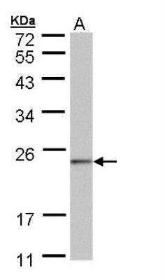 Western Blot: NDUFAF4 Antibody [NBP1-32722] - Sample (30 ug of whole cell lysate) A: 293T 12% SDS PAGE, antibody diluted at 1:1000.