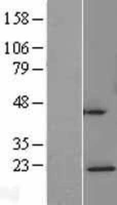 Western Blot: NDUFAF4 Overexpression Lysate (Adult Normal) [NBL1-08537] Left-Empty vector transfected control cell lysate (HEK293 cell lysate); Right -Over-expression Lysate for NDUFAF4.