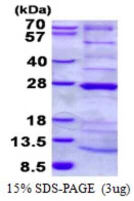 SDS-Page: NDUFAF4 Protein [NBP2-23264]