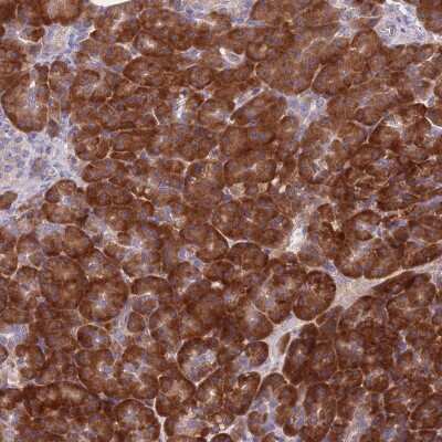 Immunohistochemistry: NDUFAF6 Antibody [NBP2-48970] - Staining of human pancreas shows strong cytoplasmic positivity in exocrine glandular cells.
