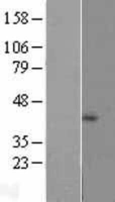 Western Blot: NDUFB1 Overexpression Lysate (Adult Normal) [NBP2-07859] Left-Empty vector transfected control cell lysate (HEK293 cell lysate); Right -Over-expression Lysate for NDUFB1.