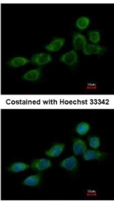Immunocytochemistry/Immunofluorescence: NDUFB10 Antibody [NBP2-19503] - Analysis of methanol-fixed A431, using antibody at 1:200 dilution.