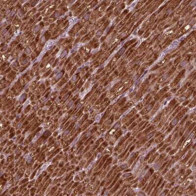 Immunohistochemistry-Paraffin: NDUFB10 Antibody [NBP2-57790] - Staining of human heart muscle shows high expression.
