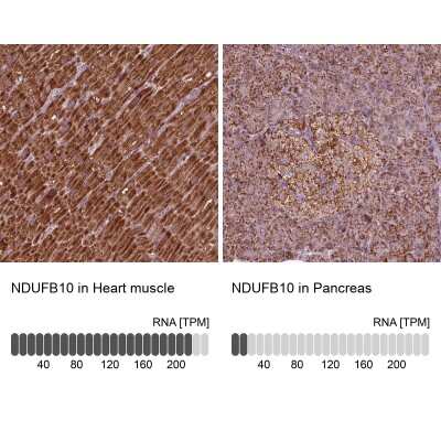 <b>Orthogonal Strategies Validation. </b>Immunohistochemistry-Paraffin: NDUFB10 Antibody [NBP2-57790] - Staining in human heart muscle and pancreas tissues using anti-NDUFB10 antibody. Corresponding NDUFB10 RNA-seq data are presented for the same tissues.