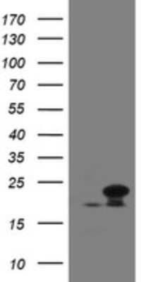 Western Blot: NDUFB10 Antibody (OTI1H6) - Azide and BSA Free [NBP2-72915] - Analysis of HEK293T cells were transfected with the pCMV6-ENTRY control (Left lane) or pCMV6-ENTRY NDUFB10.