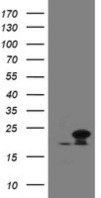 Western Blot: NDUFB10 Antibody (OTI1H6) [NBP2-46118] - Analysis of HEK293T cells were transfected with the pCMV6-ENTRY control (Left lane) or pCMV6-ENTRY NDUFB10.