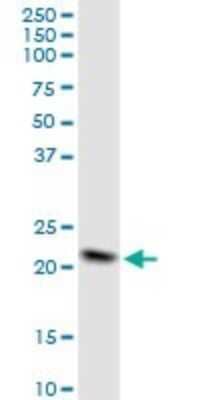 Western Blot: NDUFB10 Antibody [H00004716-B01P] - Analysis of NDUFB10 expression in Hela S3 NE.