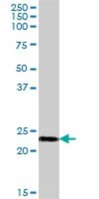 Western Blot: NDUFB10 Antibody [H00004716-B01P] - Analysis of NDUFB10 expression in human kidney.