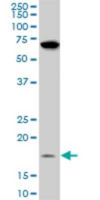 Western Blot: NDUFB11 Antibody (4B2) [H00054539-M08] - Analysis of NDUFB11 expression in A-431 (Cat # L015V1).