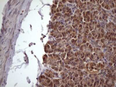 Immunohistochemistry: NDUFB11 Antibody (9C5) [NBP2-46119] - Analysis of Human pancreas tissue. (Heat-induced epitope retrieval by 1 mM EDTA in 10mM Tris, pH8.5, 120C for 3min)