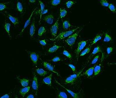 Immunocytochemistry/Immunofluorescence: NDUFB11 Antibody [NBP3-12681] - Staining of NDUFB11 in U2OS cells. Cells were fixed with 4% PFA, permeabilzed with 0.3% Triton X-100 in PBS,blocked with 10% serum, and incubated with rabbit anti-Human NDUFB11 polyclonal antibody (dilution ratio 1:200) at 4? overnight. Then cells were stained with the Alexa Fluor®488-conjugated Goat Anti-rabbit IgG secondary antibody (green) and counterstained with DAPI (blue).Positive staining was localized to Cytoplasm.