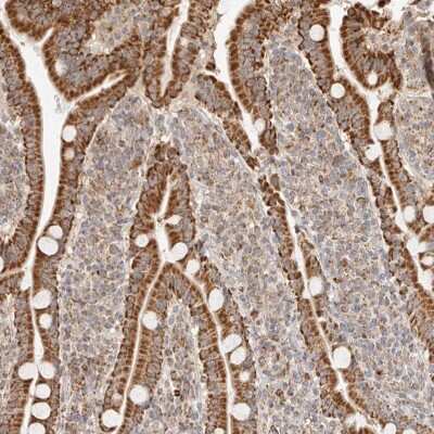 Immunohistochemistry-Paraffin: NDUFB11 Antibody [NBP1-83956] - Staining of human duodenum shows strong, granular cytoplasmic positivity in glandular cells.