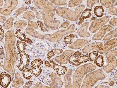 Immunohistochemistry-Paraffin: NDUFB11 Antibody [NBP3-12681] - Staining of human NDUFB11 in human kidney with rabbit polyclonal antibody at 1:500 dilution.