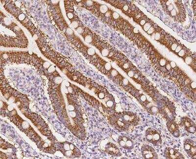 Immunohistochemistry-Paraffin: NDUFB11 Antibody [NBP3-12681] - Staining of human NDUFB11 in human small intestine with rabbit polyclonal antibody at 1:500 dilution.