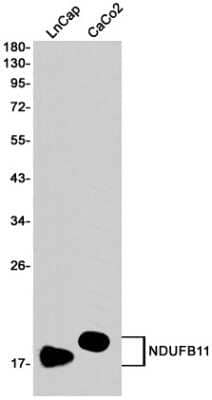 Western Blot: NDUFB11 Antibody (S08-7D9) [NBP3-15064] - Western blot detection of NDUFB11 in LnCap, CaCo2 cell lysates using NDUFB11 Rabbit mAb (1:1000 diluted). Predicted band size: 17KDa. Observed band size: 17KDa.