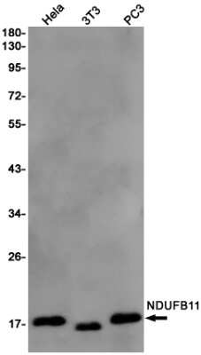 Western Blot: NDUFB11 Antibody (S08-7D9) [NBP3-15064] - Western blot detection of NDUFB11 in Hela, 3T3, PC3 cell lysates using NDUFB11 Rabbit mAb (1:1000 diluted). Predicted band size: 17KDa. Observed band size: 17KDa.