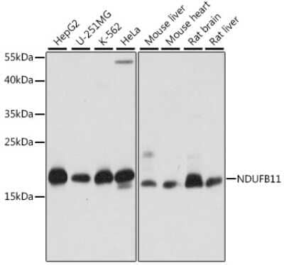 Western Blot: NDUFB11 Antibody [NBP2-93342] - Analysis of extracts of various cell lines, using NDUFB11 at 1:1000 dilution.Secondary antibody: HRP Goat Anti-Rabbit IgG (H+L) at 1:10000 dilution.Lysates/proteins: 25ug per lane.Blocking buffer: 3% nonfat dry milk in TBST.Detection: ECL Basic Kit .Exposure time: 1s.