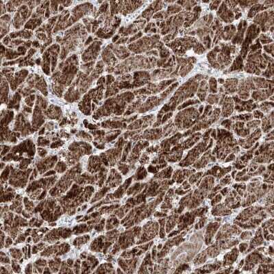 Immunohistochemistry-Paraffin: NDUFB3 Antibody [NBP1-88929] - Staining of human heart muscle shows strong cytoplasmic positivity in myocytes.