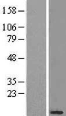 Western Blot: NDUFB3 Overexpression Lysate (Adult Normal) [NBL1-13551] Left-Empty vector transfected control cell lysate (HEK293 cell lysate); Right -Over-expression Lysate for NDUFB3.