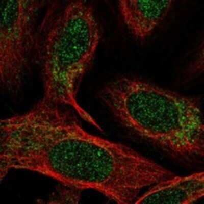 Immunocytochemistry/Immunofluorescence: NDUFB4 Antibody [NBP3-17897] - Staining of human cell line U-2 OS shows localization to nucleoplasm & mitochondria.