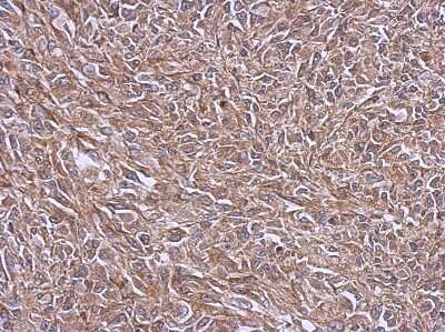 Immunohistochemistry-Paraffin: NDUFB4 Antibody [NBP2-15035] - Paraffin-embedded RT2 xenograft, using antibody at 1:500 dilution.