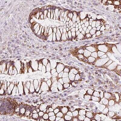 Immunohistochemistry-Paraffin: NDUFB4 Antibody [NBP2-33626] - Staining of human rectum shows strong cytoplasmic positivity in glandular cells.