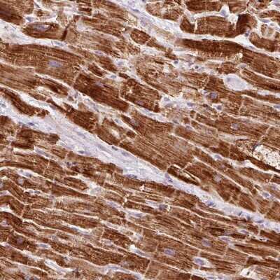 Immunohistochemistry-Paraffin: NDUFB4 Antibody [NBP2-33626] - Staining of human heart muscle shows high expression.