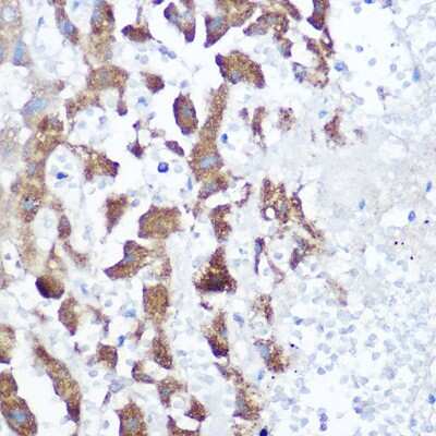 Immunohistochemistry-Paraffin: NDUFB4 Antibody [NBP3-03538] - Immunohistochemistry of paraffin-embedded human liver using [KO Validated] NDUFB4 Rabbit pAb (NBP3-03538) at dilution of 1:150 (40x lens). Perform high pressure antigen retrieval with 10 mM citrate buffer pH 6.0 before commencing with IHC staining protocol.