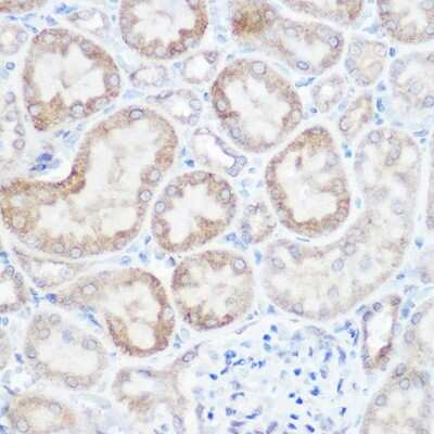 Immunohistochemistry-Paraffin: NDUFB4 Antibody [NBP3-03538] - Immunohistochemistry of paraffin-embedded mouse kidney using [KO Validated] NDUFB4 Rabbit pAb (NBP3-03538) at dilution of 1:150 (40x lens). Perform high pressure antigen retrieval with 10 mM citrate buffer pH 6.0 before commencing with IHC staining protocol.