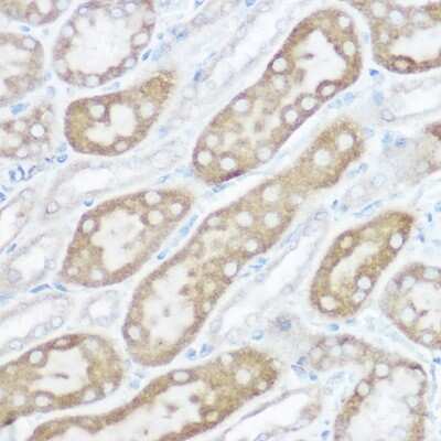 Immunohistochemistry-Paraffin: NDUFB4 Antibody [NBP3-03538] - Immunohistochemistry of paraffin-embedded rat kidney using [KO Validated] NDUFB4 Rabbit pAb (NBP3-03538) at dilution of 1:150 (40x lens). Perform high pressure antigen retrieval with 10 mM citrate buffer pH 6.0 before commencing with IHC staining protocol.