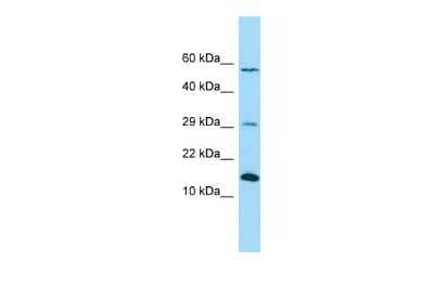 Western Blot: NDUFB4 Antibody [NBP2-85370] - WB Suggested Anti-NDUFB4 Antibody. Titration: 1.0 ug/ml. Positive Control: Fetal Lung