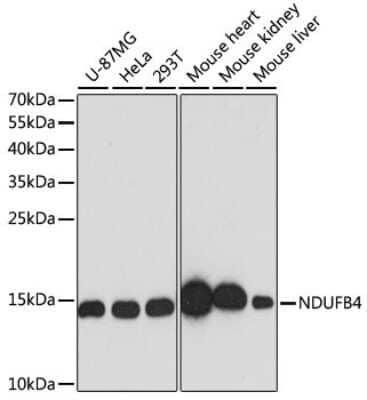 Western Blot: NDUFB4 Antibody [NBP3-03538] - Analysis of extracts of various cell lines, using NDUFB4 antibody at 1:3000 dilution. Secondary antibody: HRP Goat Anti-Rabbit IgG (H+L) at 1:10000 dilution. Lysates/proteins: 25ug per lane. Blocking buffer: 3% nonfat dry milk in TBST. Detection: ECL Basic Kit.