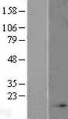 Western Blot: NDUFB4 Overexpression Lysate (Adult Normal) [NBL1-13552] Left-Empty vector transfected control cell lysate (HEK293 cell lysate); Right -Over-expression Lysate for NDUFB4.