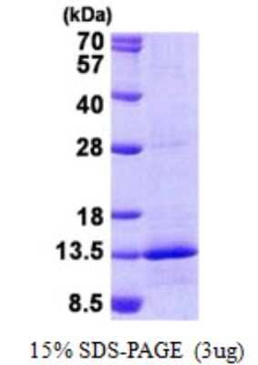 SDS-Page: NDUFB4 Protein [NBP2-23261]