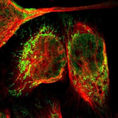 Immunocytochemistry/Immunofluorescence: NDUFB5 Antibody [NBP1-85607] - Immunofluorescent staining of human cell line U-2 OS shows localization to nucleoplasm & mitochondria. Antibody staining is shown in green.