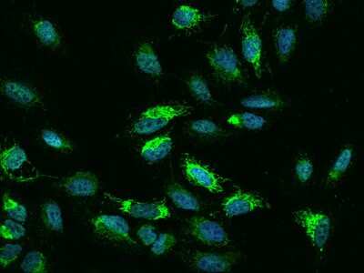 Immunocytochemistry/Immunofluorescence: NDUFB5 Antibody [NBP2-97853] - Immunofluorescence staining of NDUFB5 in U2OS cells. Cells were fixed with 4% PFA, permeabilzed with 0.1% Triton X-100 in PBS, blocked with 10% serum, and incubated with rabbit anti-Human NDUFB5 polyclonal antibody (dilution ratio 1:200) at 4C overnight. Then cells were stained with the Alexa Fluor(R)488-conjugated Goat Anti-rabbit IgG secondary antibody (green) and counterstained with DAPI (blue).Positive staining was localized to Nucleus and Cytoplasm.