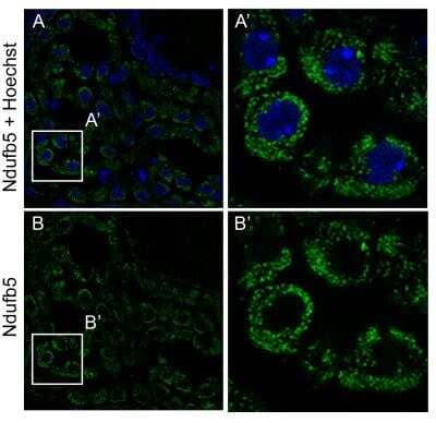 Immunohistochemistry-Frozen: NDUFB5 Antibody [NBP1-85607] - PFA-fixed cryosections (14 um) of adult mouse brain.100x confocal imaging. Mitochondria are labeled. Antigen retrieval was performed in boiling 10mM citric acid (pH6) for 15 min, followed by block in 5% goat serum (PBS/ 0.3% triton) and incubated in primary ab (1:100) overnight at 4C in goat block. Developed with goat-anti-rabbit Alexa 488. Image from verified customer review.