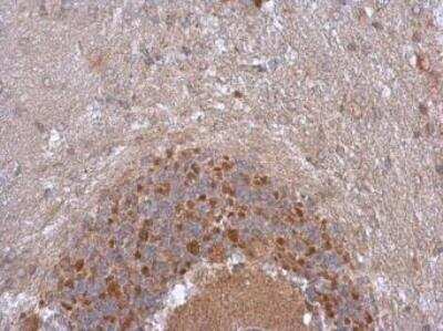 Immunohistochemistry-Frozen (Negative): NDUFB5 Antibody [NBP1-31684] - NDUFB5 antibody detects NDUFB5 protein at cytoplasm in rat brain by immunohistochemical analysis. Sample: Paraffin-embedded rat brain. NDUFB5 antibody diluted at 1:500. Antigen Retrieval: Citrate buffer, pH 6.0, 15 min