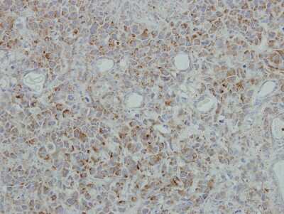 Immunohistochemistry-Paraffin: NDUFB5 Antibody [NBP1-31684] - Paraffin-embedded HBL435 xenograft, using antibody at 1:500 dilution.