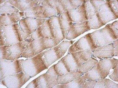 Immunohistochemistry-Paraffin: NDUFB5 Antibody [NBP1-31684] - NDUFB6 antibody detects NDUFB6 protein at cytoplasm in rat muscle by immunohistochemical analysis. Sample: Paraffin-embedded rat muscle. NDUFB6 antibody diluted at 1:500. Antigen Retrieval: Citrate buffer, pH 6.0, 15 min