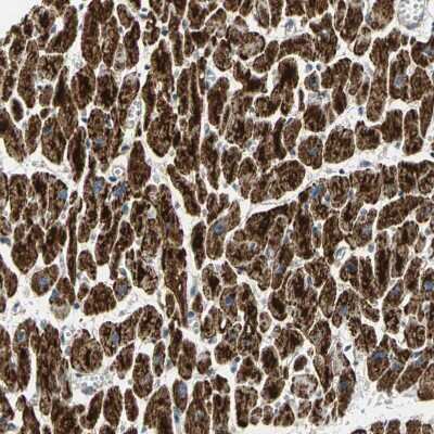 Immunohistochemistry-Paraffin: NDUFB5 Antibody [NBP1-85607] - Staining of human heart muscle shows strong positivity in mitochondria in cardiomyocytes.