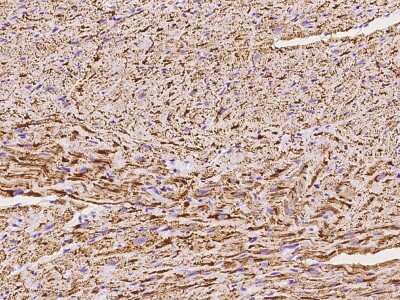 Immunohistochemistry-Paraffin: NDUFB5 Antibody [NBP2-97853] - Immunochemical staining of human NDUFB5 in cynomolgus heart with rabbit polyclonal antibody at 1:100 dilution, formalin-fixed paraffin embedded sections.