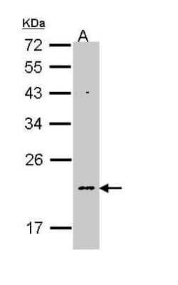 Western Blot: NDUFB5 Antibody [NBP1-31684] - (30 ug of whole cell lysate)  A: Molt-4  12% SDS PAGE diluted at 1:1000